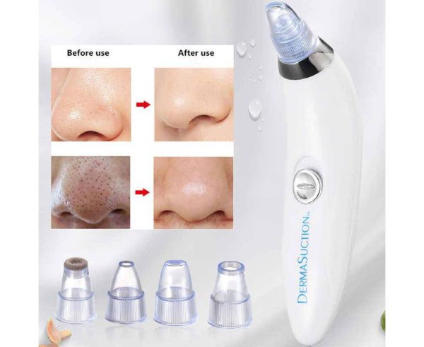 4-in-1 Blackhead Remover Machine - Derma Suction Vacuum Pore Cleaner