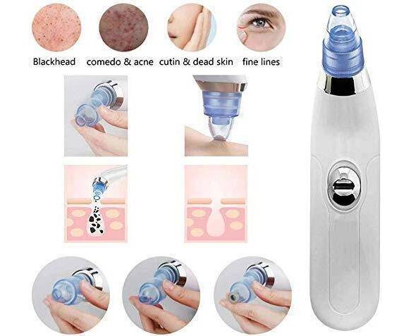 4-in-1 Blackhead Remover Machine - Derma Suction Vacuum Pore Cleaner